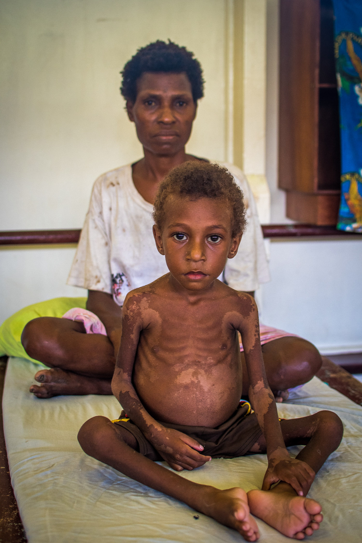 UNICEF supports the Government to provide improved nutrition and care practices particularly in disadvantaged and marginalized communities, making available therapeutic foods and nutrition supplies.