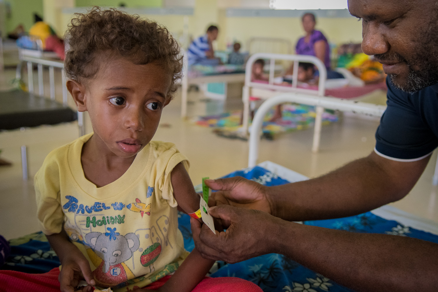 Port Moresby General Hospital’s Pediatric Ward where children are being treated for Severe Acute Malnutrition.