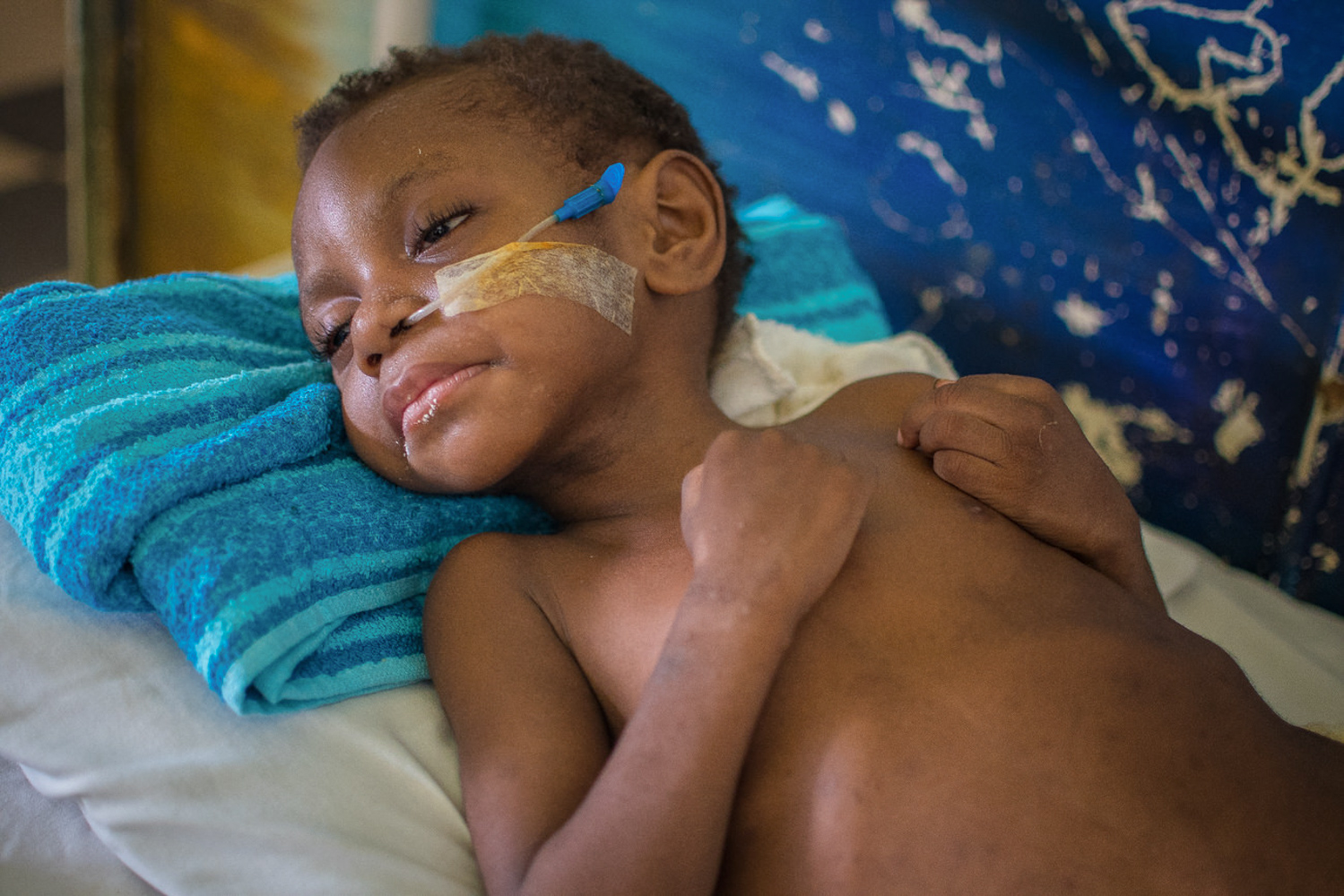 Port Moresby General Hospital. Children admitted to Port Moresby General Hospital’s Pediatric Ward where they are being treated for Severe Acute Malnutrition.