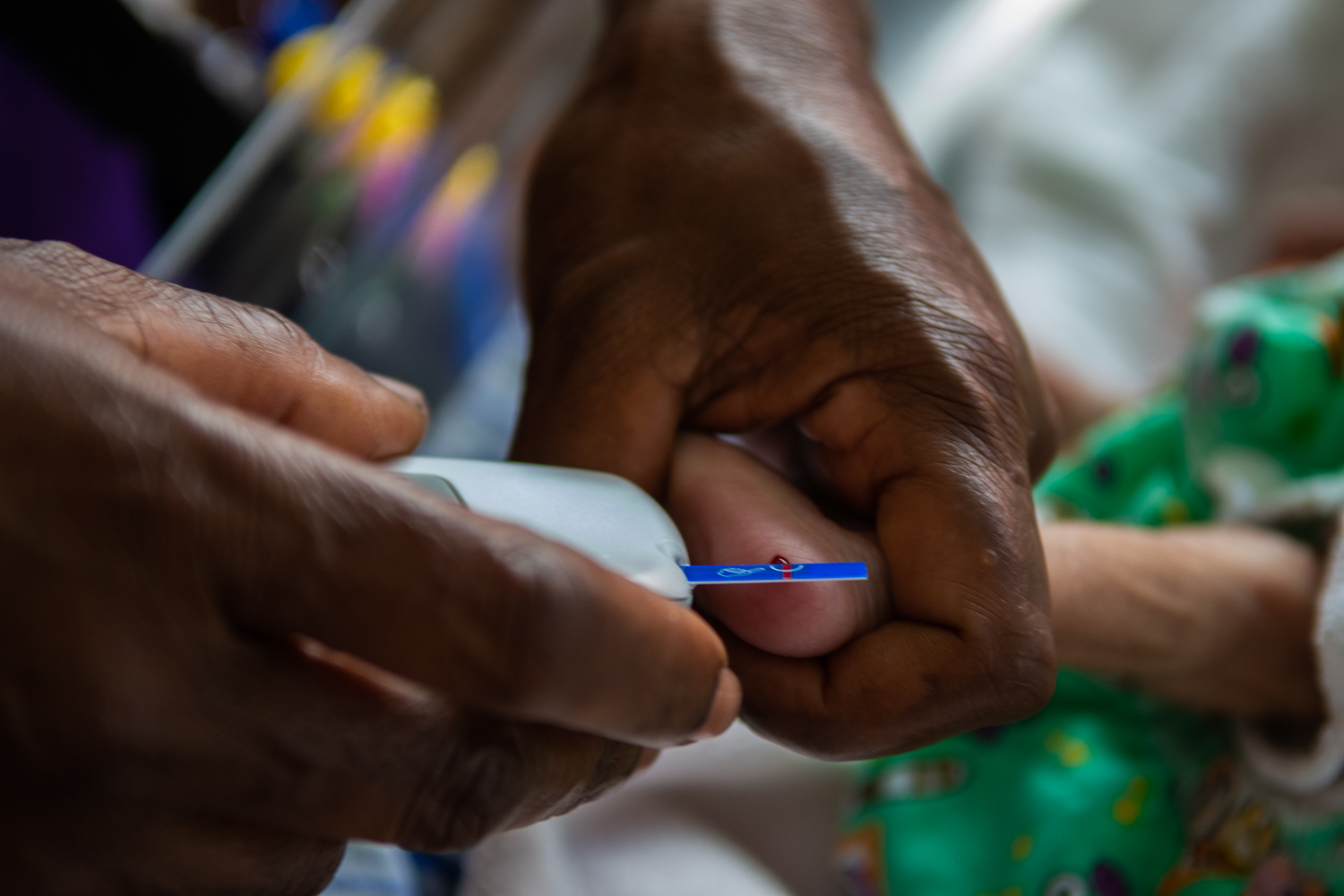 Underweight babies at the Special Care Nursery, Goroka Hospital. A doctor is extracting blood from a baby for a blood test.