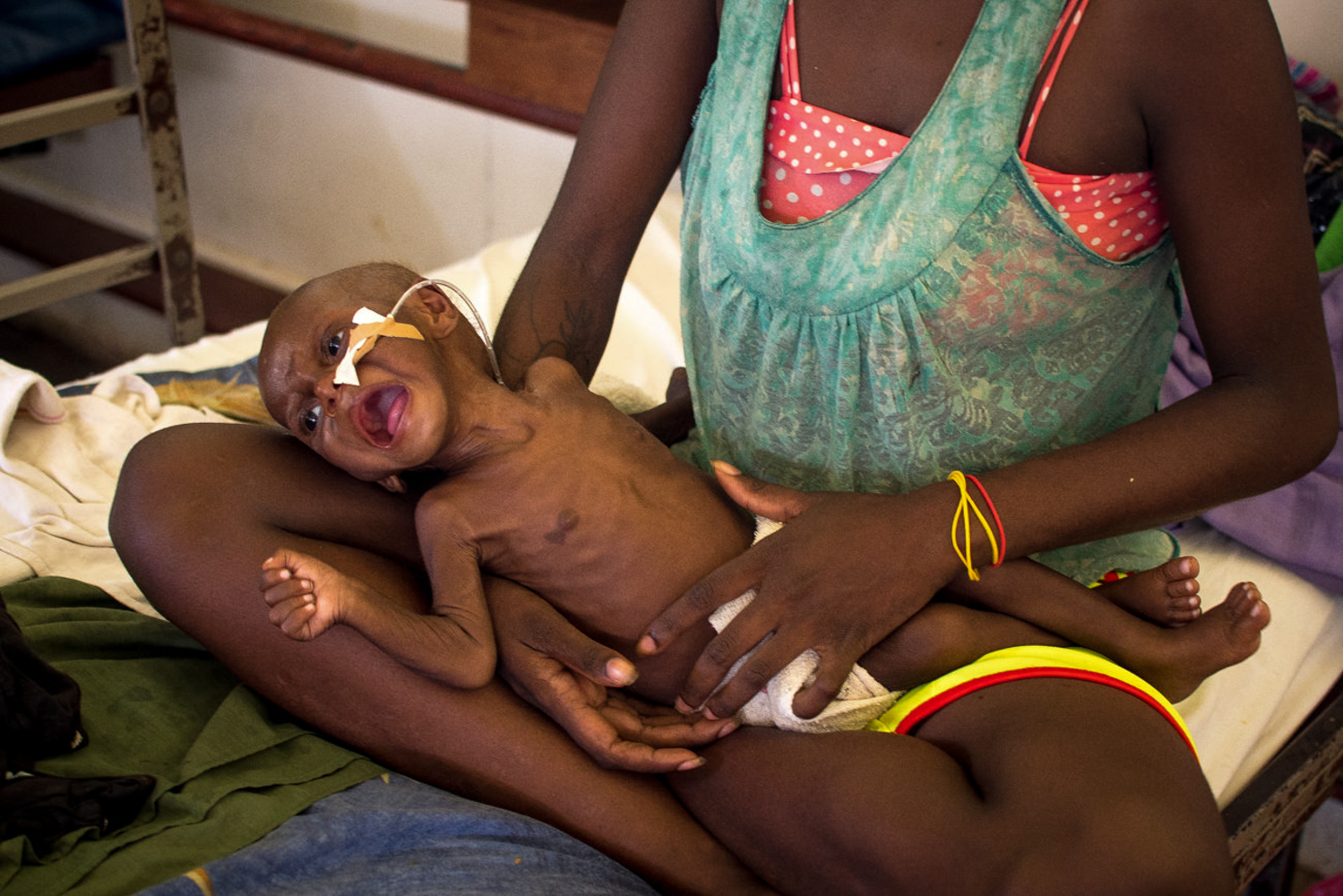 The rate of malnutrition is unacceptably high in PNG and remains a significant underlying factor for illness and deaths particularly for children under five years old.