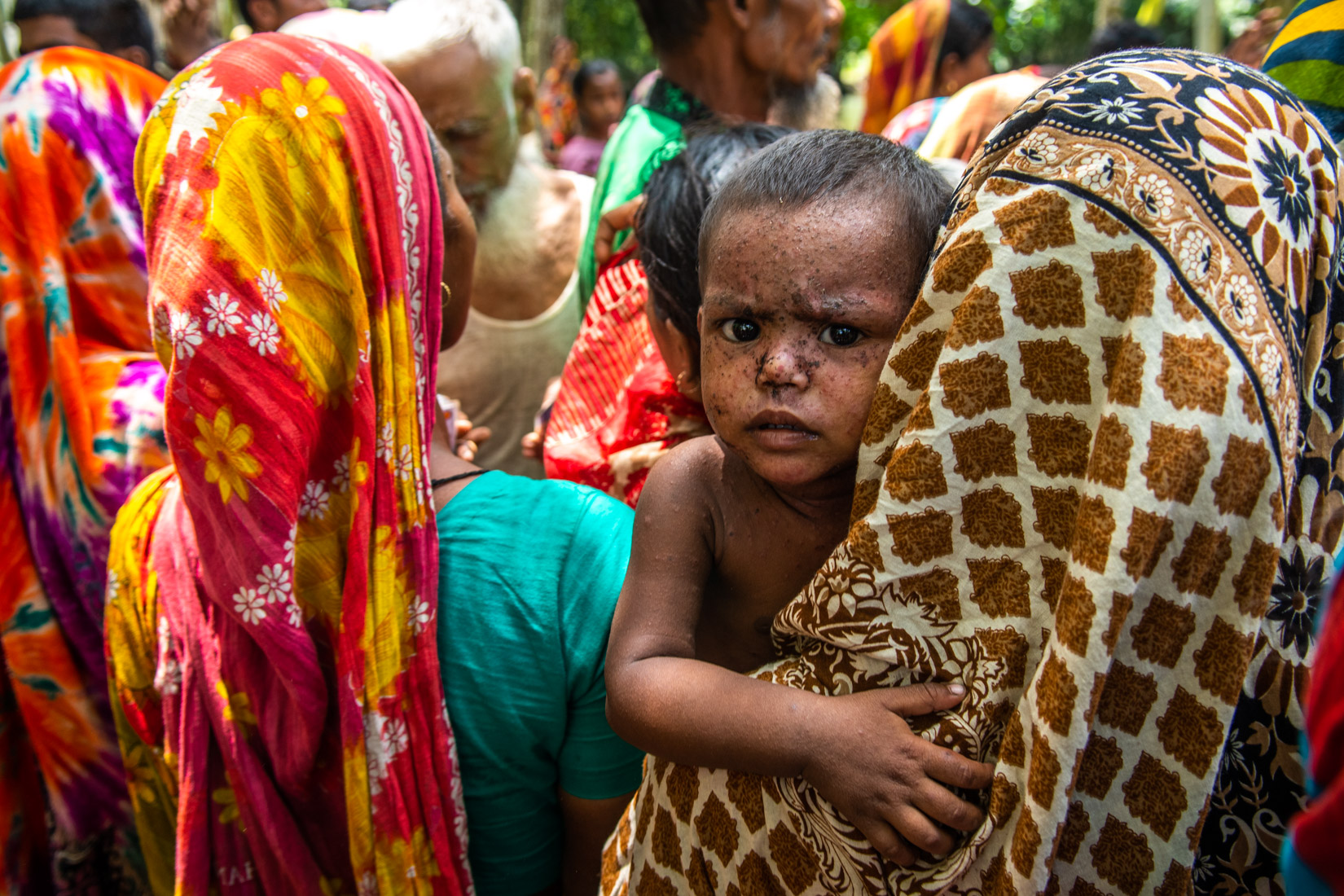 Gaibandha district. A child showing a frightened and stressful expression, probably because of the intensity of the situation lived during the last days.