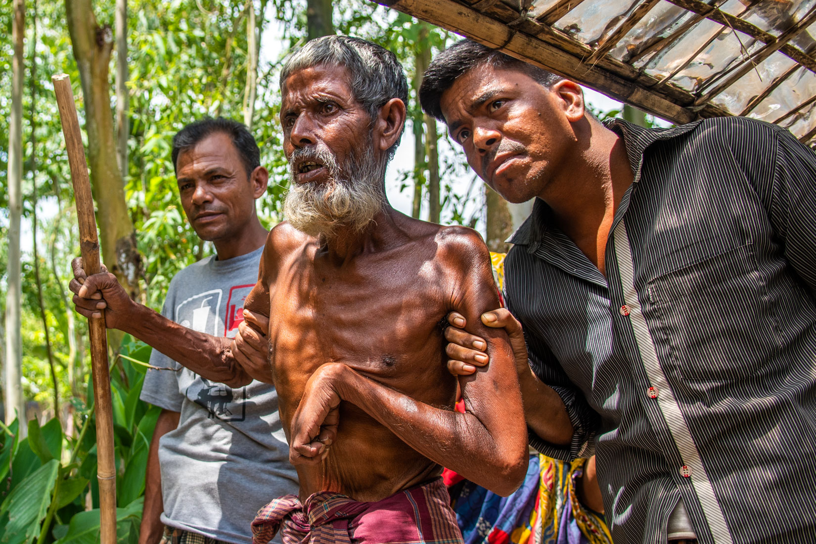 Ubaedur Rahman, 55 year old man with multi type of disabilities is selected to be registered for emergency response supplies. Flood has damaged his vegetable plots and due to fodder crisis, he has to sell his goats for survival.